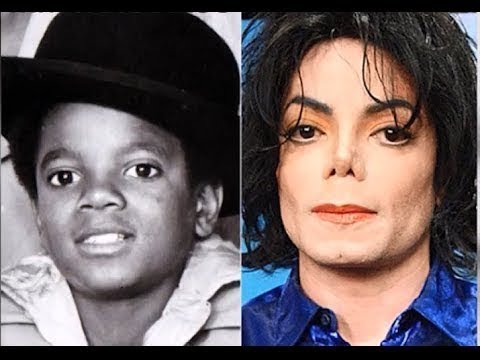วีดีโอ: Michael Jackson เปลี่ยนสีผิวอย่างไร?