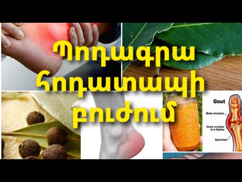 Video: Ինչ չպետք է ուտել հոդատապով