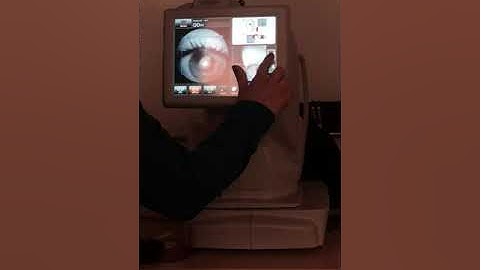 Topcon maestro- 3D wide OCT