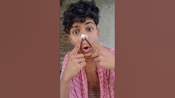 How I Cured a Bug Bite with Yogurt in the#shortvideo