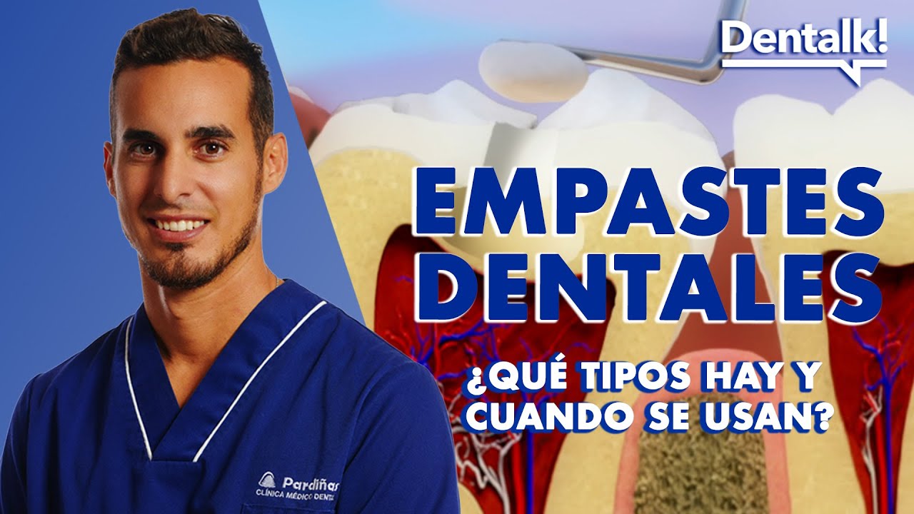 ¿Tienes un EMPASTE o van a hacértelo? - Así se curan las CARIES | Dentalk! ©