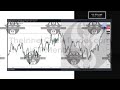 ICT private mentorship tips & insights: market structure shifts vs breaks