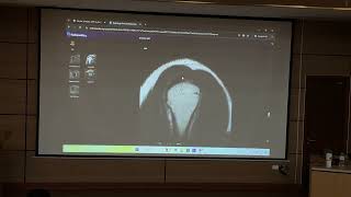 MRI khớp vai   Ts Nguyễn Duy Hùng