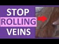 Prevent a Rolling Vein When Starting an IV or Drawing Blood