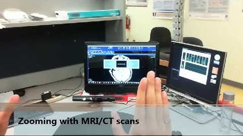 MS Kinect Gesture & Voice Control for HRS PACS System in OR