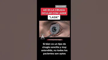 ¿Cuántas veces puede hacerse la cirugía LASIK?