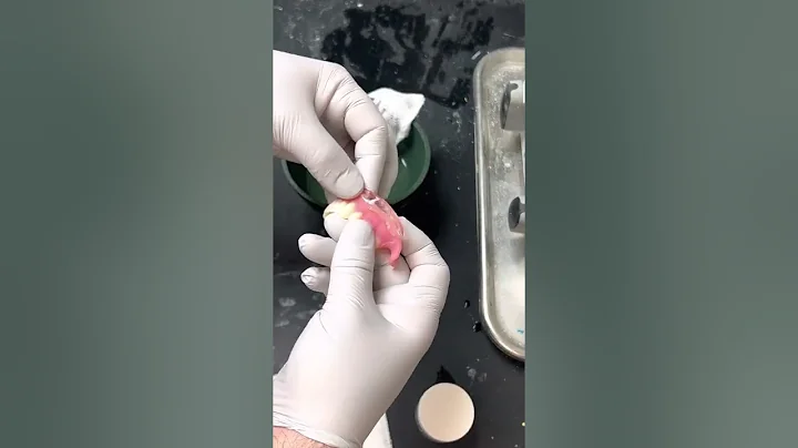 Little trick with thermoplastic beads for dentures