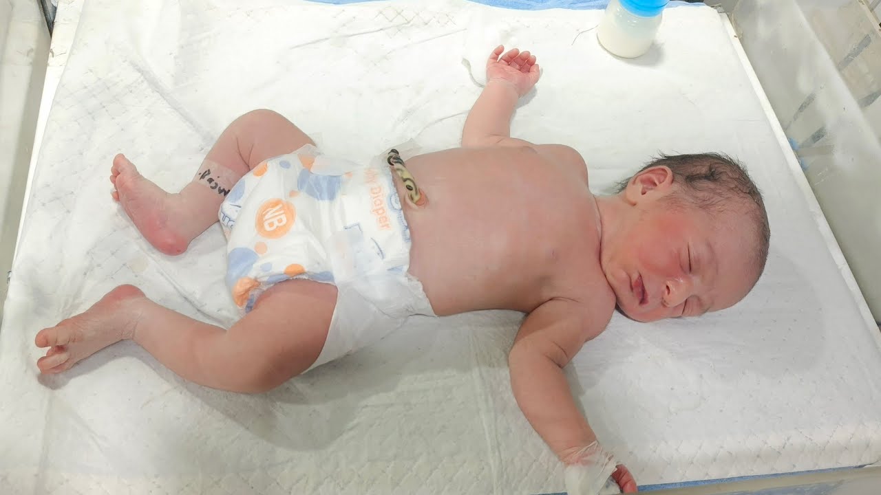 🔴 LIVE | Newborn Baby with Hypoglycemia & Phenobarbital Therapy | NICU Critical Care Update