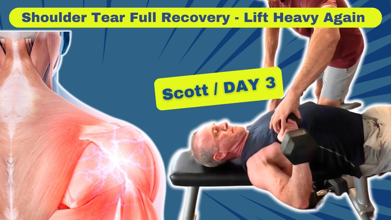 Shoulder Tear Full Recovery Lifting Heavy Again - Scott Day 3/3 - YouTube