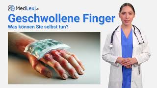 Geschwollene Finger - Das kannst du tun! - Wann zum Arzt? - Ursachen & Behandlung | MedLexi.de