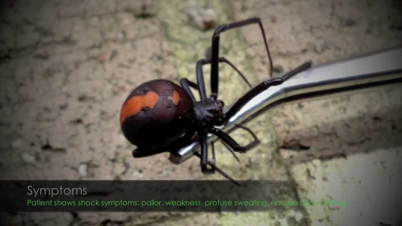 Spider bites - treatment, symptoms and first aid