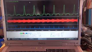 видео: ВАЗ 2114 Е-газ неровный холостой ход. Диванным экспертам не смотреть! Любительская диагностика. картинка: ВАЗ 2114 Е-газ неровный холостой ход. Диванным экспертам не смотреть! Любительская диагностика.