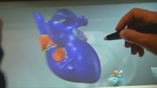 Future Of Cardiology Includes Your Heart In 3D screenshot 4