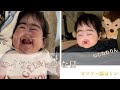 【ホットリン】ハイテンション/緊張強い日/日常/節分/医療的ケア/口唇裂/1歳