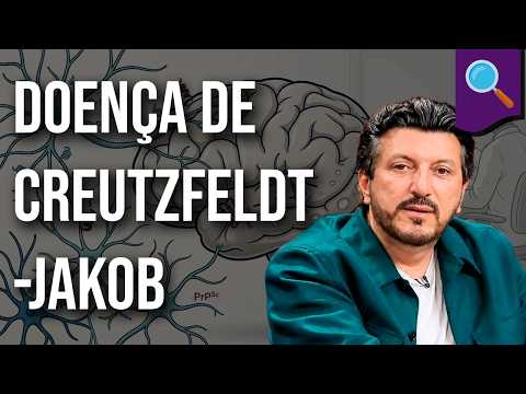 Demystifying Creutzfeldt-Jakob Disease