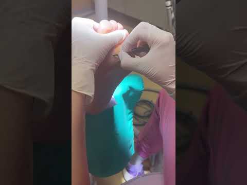 👣 Quiropodia –Centro de Podología Las Ramblas cuida la salud de tus pies para que vuelvas a caminar