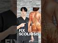 Fix Scoliosis With Two Principles mp3