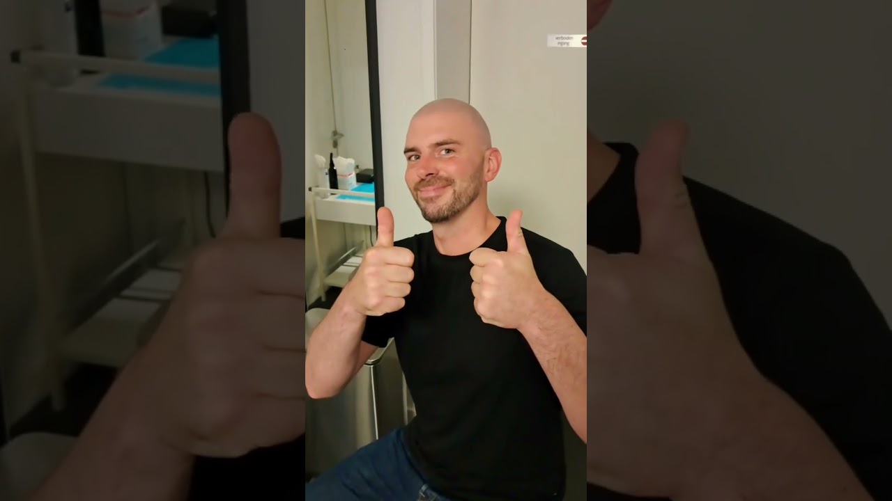 Nooit meer kaal! Micro haar pigmentatie de oplossing!