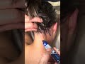 MIGRAÑAS, CEFALEAS, VÉRTIGO, ANSIEDAD.