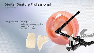 Digital Denture – first Appointment