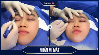 List 20+ nhấn mí review hot nhất