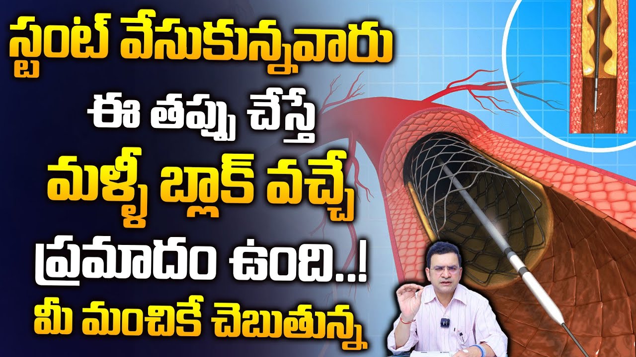 Dr Movva Srinivas : స్టంట్ వేసుకున్నవారు ఈ తప్పు చేస్తే మళ్ళీ బ్లాక్ ..?|Blocks After Bypass Surgery