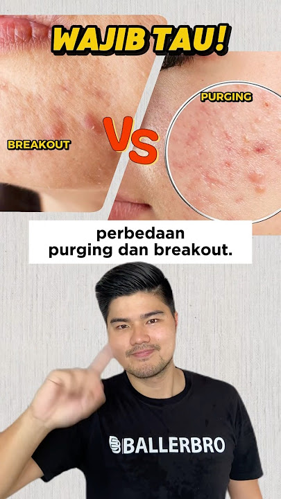 bedain ya yang mana purging dan breakout guys!!#skincare #glowup #breakout #purging