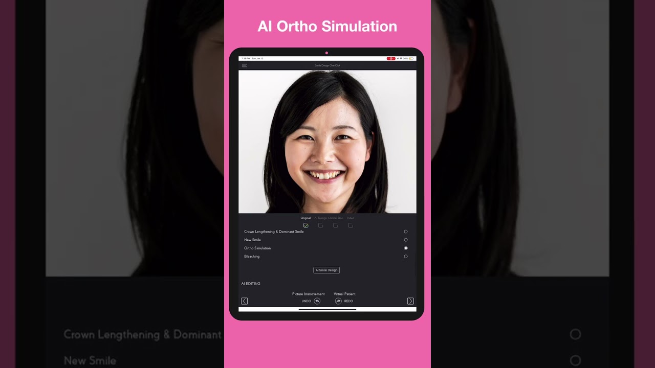 SmileFy 4.8, - ONE-CLICK AI smile simulation - YouTube