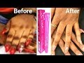 HOW I GOT RID OF MY DARK KNUCKLES IN 2 DAYS WITH SO WHITES TUBE