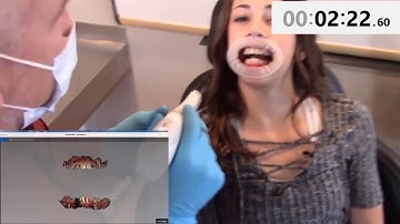 Carestream Dental CS 3600 Intraoral Scanner   Real Time Scan