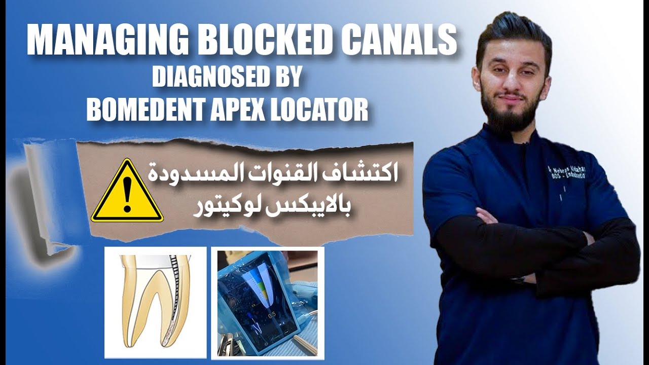 Managing Blocked Canals Diagnosed by Bomedent Apex Locator | Dr. Nebras Al-Dahash