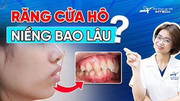 Thời Gian Niềng Răng Cửa Hô? Làm Thế Nào Để Rút Ngắn Thời Gian Niềng Răng