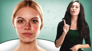 Blotchy Skin: Prevention and Treatments You Need to Know