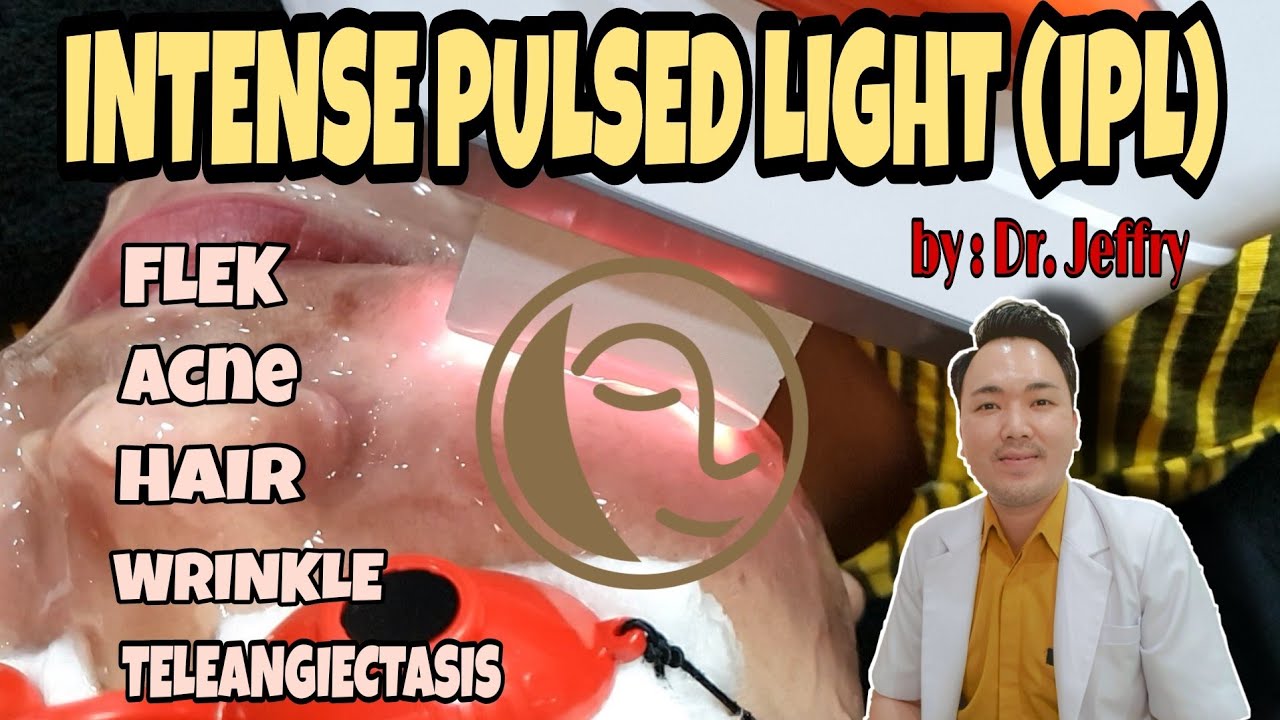 IPL (Intense Pulsed Light) di NATASHA SKIN CARE (PADANG) dr. JEFFRY