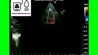 Echocardiography