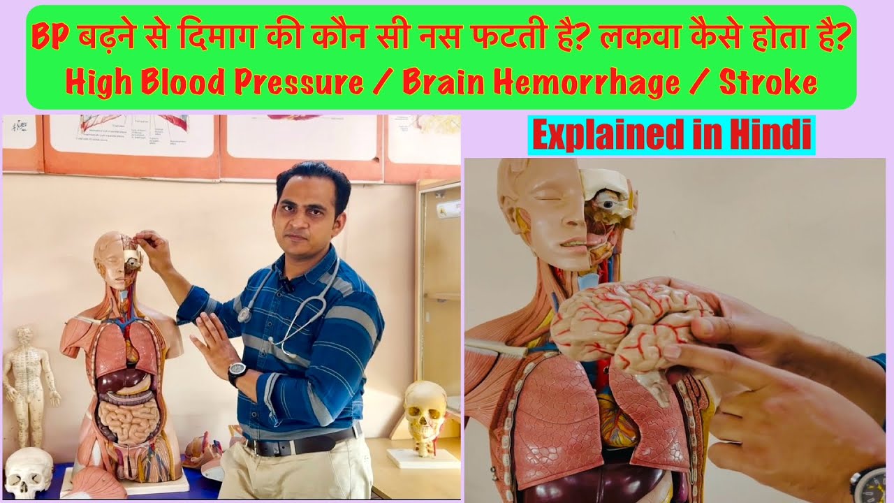 BP बढ़ने से दिमाग की कौन सी नस फटती है लकवा कैसे होता है | Blood Pressure, Brain Hemorrhage & Stroke