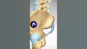 See how a Sacroiliac Joint Fusion restores function and relieves pain in 3D animation.