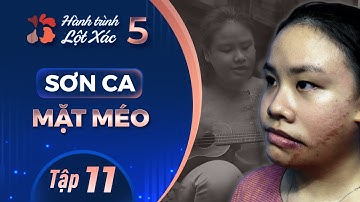 Hành Trình Lột Xác mùa 5 | Tập 11: Trần Thanh Hiền Sơn ca "mặt méo"