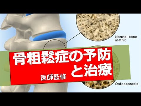 ビタミンd サプリ飲んで本当に効果あるの 総合診療医ドクターpチャンネル 元救急医の挑戦 In 宮崎