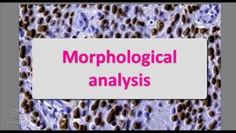 3DHISTECH - How NuclearQuant works