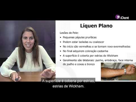 Vídeo: Tratamento De Líquen Líquen Em Humanos - 7 Remédios