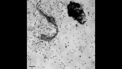 Tế bào bạch cầu tấn công giun ký sinh !