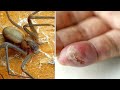 10 Most Dangerous Animals in the U.S.