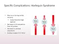 STS U 2020 Course 5: ECMO Cannulation