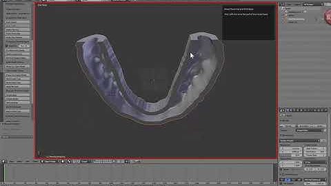 D3Splint - BasingModels