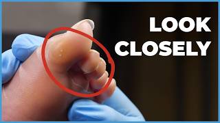 Adaptive Pedicure Techniques Caring For Clients With Mobility Differences