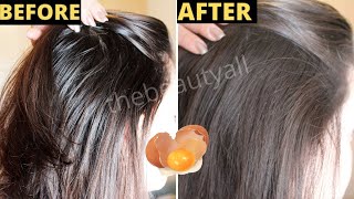 HOW TO TREAT OILY HAIR & GREASY HAIR NATURALLY || OILY SCALP HOME REMEDY INSTANT RESULT