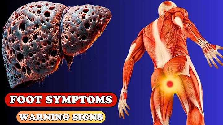 Warning Signs: 9 Unexpected Foot Symptoms of Liver Damage | Health care - DayDayNews