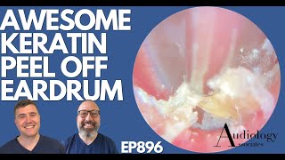 AWESOME KERATIN PEEL OFF EARDRUM - EP896 screenshot 3