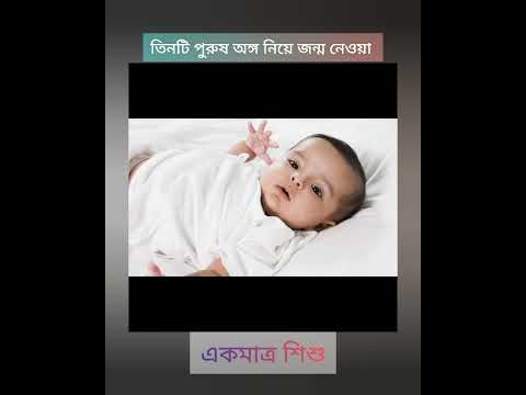 তিনটি পুরুষাঙ্গ নিয়ে জন্ম নেওয়া একমাত্র শিশু !! The only child born with three penises #facts